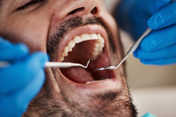 Best Knocked-Out Tooth Emergency  in Dolan Springs, AZ