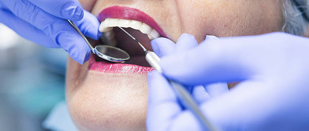 Best Chipped Tooth Repair Near Me  in Dolan Springs, AZ